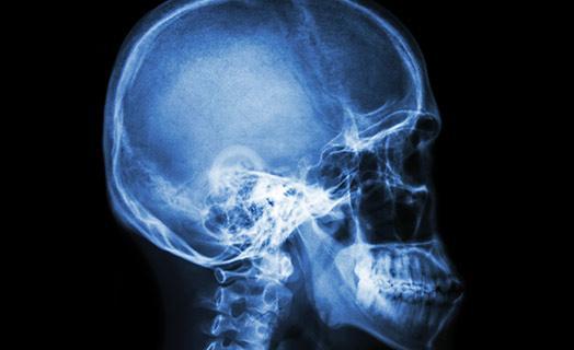 csi college of southern idaho x ray of a human skull